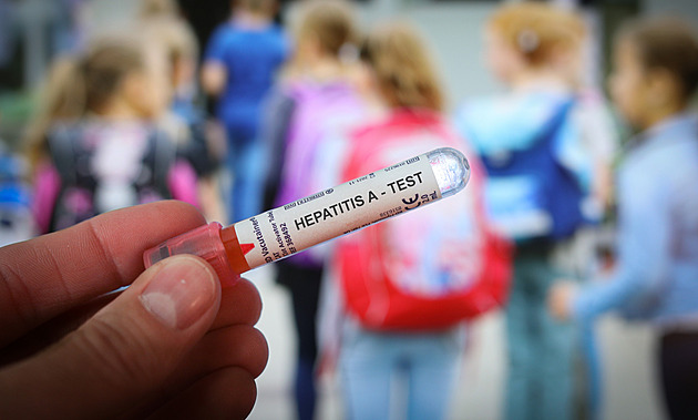 Epidemie žloutenky A je největší od roku 1984, nejvíc nakažených je v Praze